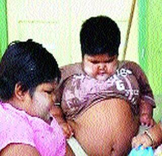 40 percent of children obesity genetic | ४० टक्के मुलांचा लठ्ठपणा आनुवंशिक