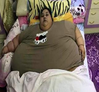 Believe in taking treatment in Mumbai, weighing 262 kg | मुंबईत उपचार घेत असलेल्या इमानचे घटले 262 किलो वजन