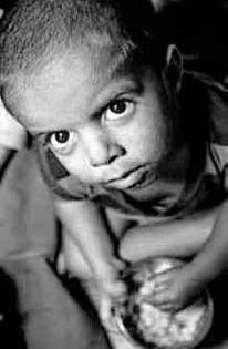 507 children die in the year | वर्षभरात ५०७ बालकांचा मृत्यू 507 children die in the year | वर्षभरात ५०७ बालकांचा मृत्यू