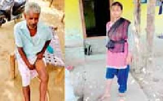 Two injured in Randukar attack | रानडुकराच्या हल्ल्यात दोघे जखमी
