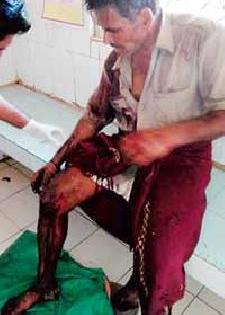Aslavi attacks in Melghat increased | मेळघाटात अस्वलीचे हल्ले वाढले Aslavi attacks in Melghat increased | मेळघाटात अस्वलीचे हल्ले वाढले