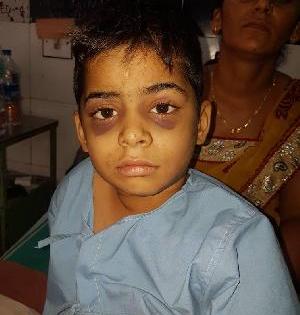 Ahmednagar schoolgirl inhumanly beaten Kolhapur | अहमदनगरच्या शाळकरी मुलास कोल्हापूरात अमानुष मारहाण