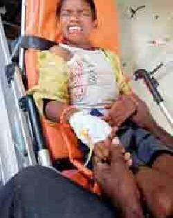 Student wounded by electric shock | विजेच्या झटक्याने विद्यार्थी जखमी Student wounded by electric shock | विजेच्या झटक्याने विद्यार्थी जखमी