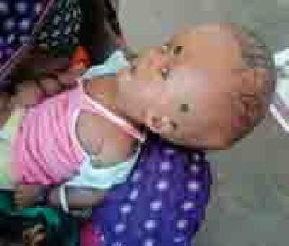 Life Insurance has been given to Rohin by the death penalty | मृत्यूच्या दाढेतून ‘रोहण’ला मिळाले जीवनदान