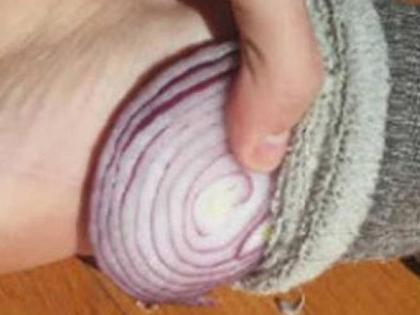 Health Benefits of putting slices of onion in socks while sleeping | झोपताना पायाखाली कांदा ठेवण्याचे हे आरोग्यदायी फायदे माहीत आहेत का?