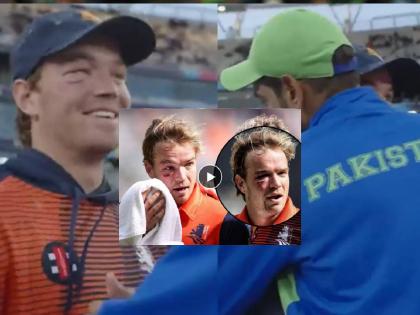 pak vs ned haris rauf ball hurt netherlands player Bas de Leede eye, watch video | VIDEO: हारिस रौफने जिंकली मनं! सामन्यानंतर बॅस डी लीडला मिठी मारली आणि म्हणाला... 