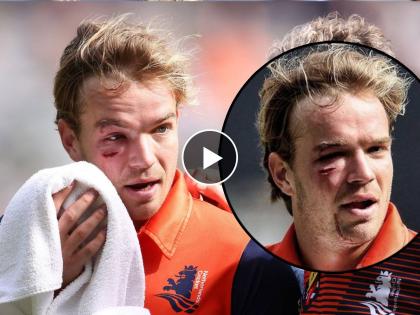 T20 World Cup, PAK vs NED : Bas de Leede, who got hit by Haris Rauf's nasty bouncer suffered concussion and has been replaced by Logan van Beek, Video | T20 World Cup, PAK vs NED : हॅरीस रौफने नेदलँड्सच्या फलंदाजाचा डोळा जवळपास फोडलाच होता; बघा कसा काढला राग, Video