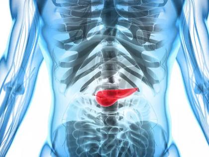 New treatment triggers self-destruction of pancreatic cancer cells | खूशखबर! स्वादुपिंडाच्या कॅन्सरवर सापडला ठोस उपाय, मूळातून नष्ट होणार कॅन्सर...