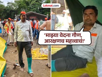 'My pain is secondary, reservation is important!'; Farm worker steps into Mumbai despite fractured leg | 'माझ्या वेदना गौण, आरक्षणच महत्त्वाचं!'; पाय फ्रॅक्चर असूनही शेतमजूराचे मुंबईत पाऊल 'My pain is secondary, reservation is important!'; Farm worker steps into Mumbai despite fractured leg | 'माझ्या वेदना गौण, आरक्षणच महत्त्वाचं!'; पाय फ्रॅक्चर असूनही शेतमजूराचे मुंबईत पाऊल