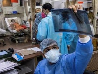 Corona Death Audit: 56% of patients already have the disease | कोरोना डेथ ऑडिट: ५६ टक्के रुग्णांना आधीपासूनच आजार