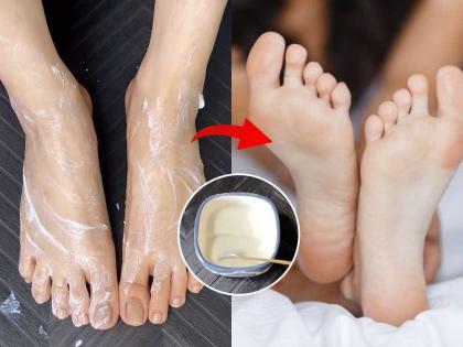 DIY Pedicure: Get salon-like feet at home with 5 kitchen ingredients. - English News | DIY Pedicure: Get salon-like feet at home with 5 kitchen ingredients. | Latest News at Lokmattimes.com