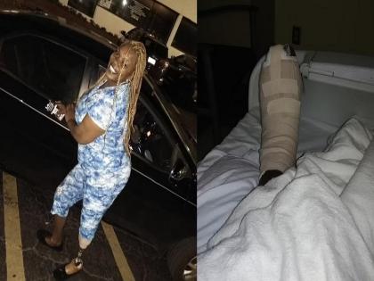 pedicure infection to woman who got 1 75 million dollar as settlement for losing leg | Pedicure करुन घेणं पडलं महागात, कापावा लागला पाय; सलॉनकडून १३ कोटींची नुकसान भरपाई