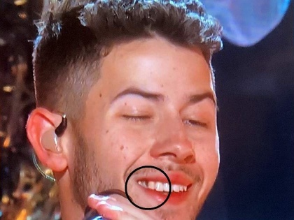 twitterati troll nick jonas after noticing green in his teeth during Grammy Awards 2020 | कल रात पालक खाया था क्या? नेटक-यांनी घेतली निक जोनासची मजा