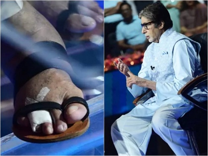 Amitabh Bachchan Toe Fractured Still Manages To Shoot Kaun Banega Crorepati 13 | असह्य वेदना पण ‘शो मस्ट गो ऑन’; अमिताभ बच्चन यांच्या तळपायाच्या बोटाला फ्रॅक्चर 