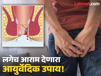 Doctor told a effective home remedies to treat piles or bawasir at home | पाइल्सची समस्या दूर करणारा सोपा आयुर्वेदिक उपाय, जाणून घ्या कसा कराल वापर!