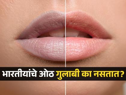 भारतीयांचे ओठ गुलाबी का नसतात? AIIMS डॉक्टरांनी सांगितलं कारण, सुंदर ओठांचं सिक्रेट - Marathi News | Why Indians have dark lips AIIMS doctor Causes of lip pigmentation in Indians How to get pink lips naturally at Home remedies for dark lips in Marathi How to lighten dark lips permanently | Latest sakhi News at Lokmat.com