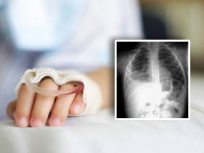 child pneumonia outbreak in us after china ohio warren county high number of pediatric cases | चीननंतर आता अमेरिकेत धडकला धोकादायक न्यूमोनिया; राज्यात आणीबाणी लागू करण्याची वेळ येणार?