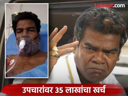४ वर्षात ७५० इंजेक्शन्स! दारूमुळे अंथरुणाला खिळला अभिनेता; किडनी फेल, आयुष्य झालं उद्ध्वस्त