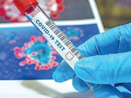 Another 12 corona positive patients were found in Akola district | अकोला जिल्ह्यात आणखी १२ कोरोना पॉझिटिव्ह रुग्ण आढळले