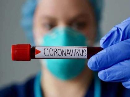 Nagpur again has a high number of patients, 63 positive | CoronaVirus in Nagpur : नागपुरात पुन्हा रुग्णसंख्येचा उच्चांक, ६३ पॉझिटिव्ह