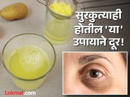 How to use potato to remove eye dark circles | डोळ्याखालचे काळे डाग आणि सुरकुत्या दूर करेल बटाट्याचा रस, जाणून घ्या कसा वापराल!