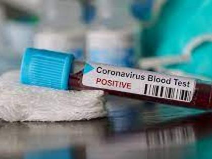 Corona Cases : 518 corona positive, one dies in Buldana district | Corona Cases : बुलडाणा जिल्ह्यात ५१८ कोरोना पॉझिटिव्ह, एकाचा मृत्यू