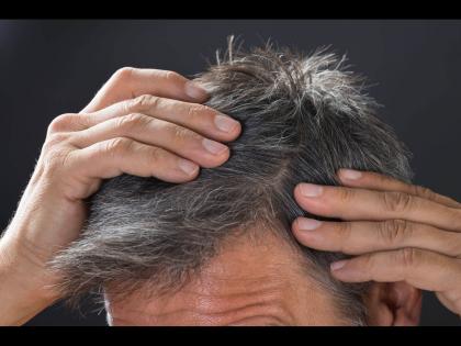 Due to these 4 reasons hair turns grey before the age of 40 stop it like this | 'या' 4 कारणांमुळे 40 वयाच्या आधीच पांढरे होतात केस, जाणून घ्या उपाय