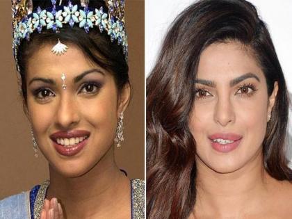 Bollywood Actress before and after Plastic Surgery | प्लॅस्टिक सर्जरीआधी अशा दिसायच्या 'या' बॉलिवूड अभिनेत्री!