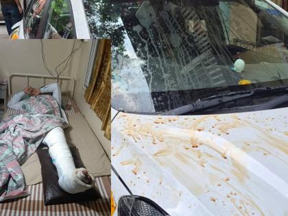 Pune Car Accident I stopped to have tea and lost my footing The young man told his story | Pune Car Accident : 'चहा घ्यायला थांबलाे अन् पाय गमावून बसलाे'! तरुणाने सांगितली आपबीती Pune Car Accident I stopped to have tea and lost my footing The young man told his story | Pune Car Accident : 'चहा घ्यायला थांबलाे अन् पाय गमावून बसलाे'! तरुणाने सांगितली आपबीती