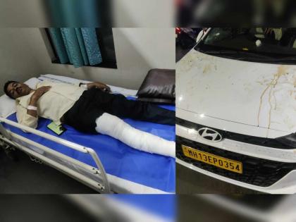 Another car accident in Pune, car driver runs over 12 people near Bhave High School, three suffer fractures | पुण्यात पुन्हा ‘कार’नामा, भावे हायस्कूलजवळ कारचालकाने १२ जणांना उडविले, तिघांना फ्रॅक्चर Another car accident in Pune, car driver runs over 12 people near Bhave High School, three suffer fractures | पुण्यात पुन्हा ‘कार’नामा, भावे हायस्कूलजवळ कारचालकाने १२ जणांना उडविले, तिघांना फ्रॅक्चर