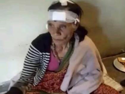 grand mother bravely fight with leopard | आजीबाईंमध्ये संचारली रणरागिणी : बिबट्याशी केले दोन हात !