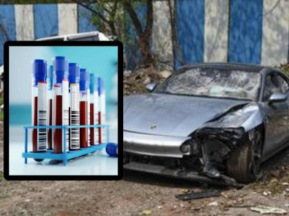 Porsche Car Accident Blood Sample of Accused Exchanged at Sassoon Hospital; Who was that guy discussions on peak | Porsche Car Accident: 'बाळा'च्या ब्लड सँपलची ससून रुग्णालयात अदलाबदल; ते खासगी इसम कोण?