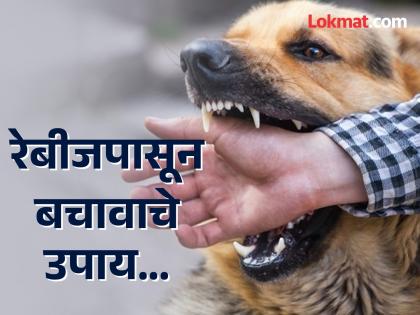 Expert shares everything about this dangerous Rabies disease | तामिळनाडूमध्ये रेबीजमुळे गेला चार वर्षाच्या मुलाचा जीव, एक्सपर्ट सांगतात कसा कराल बचाव!