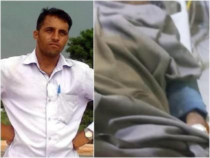 crime news attack on rti activist rajasthan broke hands and feet put rods in feet | राजस्थान : RTI कार्यकर्त्यासोबत गुंडांचे 'तालिबानी' कृत्य; हात-पाय तोडून खिळेही ठोकले