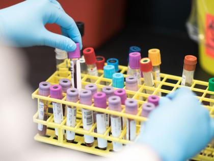 तुमचा रक्तगट B+, O+ आहे का?; कॅलिफोर्निया यूनिवर्सिटीतील संशोधकांच्या रिपोर्टमधून नवी माहिती समोर