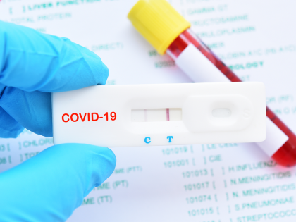 some drinks can lead to false covid positive test result research shows | 'या' ड्रिंक्समुळे तुमची कोव्हिड टेस्ट तुम्हाला कोरोना झालेला नसतानाही पॉझिटिव्ह येऊ शकते...