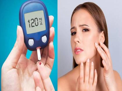 Type 2 diabetes warning sign on face early symptoms | चेहऱ्यावर दिसू लागली ही लक्षणं तर वेळीच व्हा सावध, डायबिटीस असू शकतो!