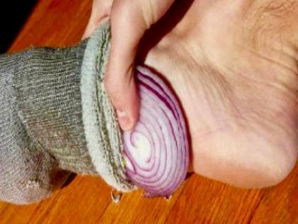 Health Tips : Benefits putting slices onion socks while sleeping | झोपताना पायाखाली कांदा ठेवण्याचे हे आरोग्यदायी फायदे माहीत आहेत का?