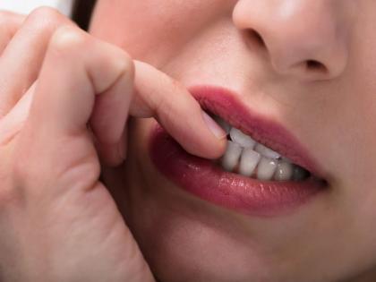 Health Tips : Risks nail biting and how stop biting your nails | नखं खाण्याची सवय अशी पडू शकते महागात, वाढू शकतो या गंभीर आजारांचा धोका