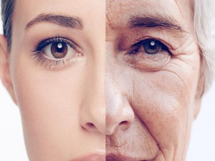 Wrinkles before time: 5 reasons you have wrinkles | वाढत्या वयासोबत या ५ कारणानी वाढतात चेहऱ्यावर सुरकुत्या, वेळीच व्हा सावध!