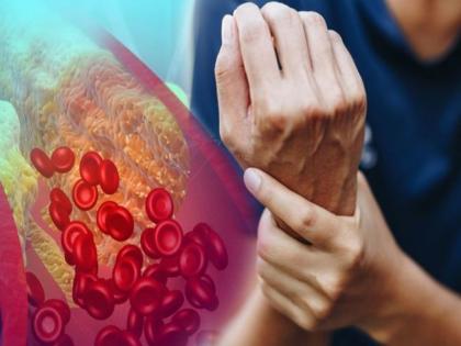 High Cholesterol symptoms warning sign in hands, you should know this | Cholesterol वाढल्यावर हातांवर दिसतात ही लक्षणे, दुर्लक्ष करणं पडू शकतं महागात