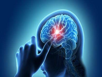 Blood group type could predict your stroke risk a blood group is at higher risk | या ब्लड ग्रुपला जास्त राहतो स्ट्रोकचा सर्वात जास्त धोका, वेळीच व्हा सावध