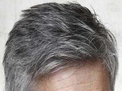 Gray hair problem young age, know how take care it | कमी वयातच पांढरे झालेले केस पुन्हा करा काळे, कसे ते जाणून घ्या!