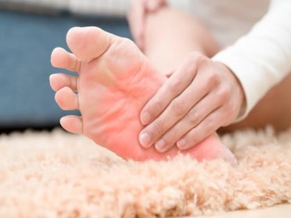 Feet burn problem do not ignore the burning sensation in the feet this could be the reason | तळपायांमध्ये होत असेल जळजळ तर करू नका दुर्लक्ष, असू शकतात ही गंभीर कारणं...