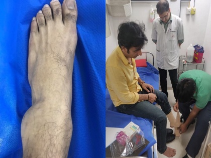 sankarshan karhade's leg was swollen but he did two shows of tu mhanshil tasa | पायाला दुखापत झाल्यानंतर उभं राहाण्याची ताकदही नसताना या अभिनेत्याने केले नाटकाचे दोन प्रयोग