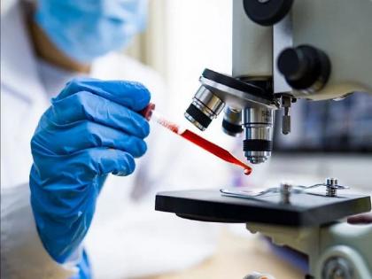 Pune-based Pharma company to begin trials of medicines with potential to treat coronavirus