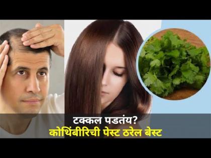 डोक्याच्या पुढच्या बाजूने टक्कल पडायला सुरुवात | Coriander Benifits | Hair Care | Hairfall