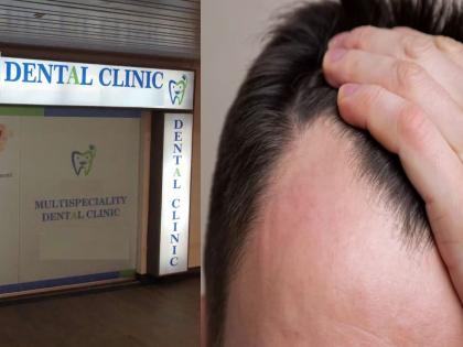 Hair loss? Bald? Go to the dentist... 'hair transplant' allowed | केस गळताहेत? टक्कल पडतंय? जा डेंटिस्टकडे...  ‘हेअर ट्रान्सप्लांट’ची परवानगी