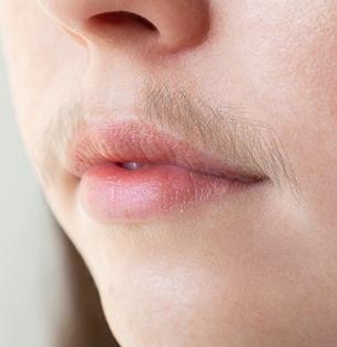 चेहऱ्यावरचे केस काढणारा १ भन्नाट फेसमास्क, केसांसह टॅनिंगही झटक्यात होईल कमी-बाकी झंझट विसरा!