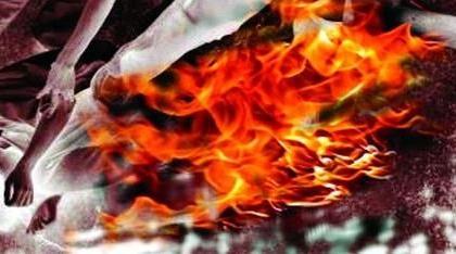 In Nagpur, °youth himself burnt by love affair | नागपुरात प्रेमप्रकरणातून स्वत:ला जाळून घेतले